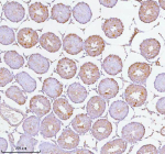 Immunohistochemical staining of SOAT1 using anti-SOAT1 antibody. SOAT1 was detected in a paraffin-embedded section of rat testis tissue. Heat mediated antigen retrieval was performed in EDTA buffer (pH 8.0, epitope retrieval solution). The tissue section was blocked with 10% goat serum. The tissue section was then incubated with 2 ug/ml rabbit anti-SOAT1 antibody overnight at 4oC. Peroxidase Conjugated Goat Anti-rabbit IgG was used as secondary antibody and incubated for 30 minutes at 37oC. The tissue section was developed using an HRP secondary and DAB substrate.