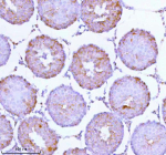 Immunohistochemical staining of SOAT1 using anti-SOAT1 antibody. SOAT1 was detected in a paraffin-embedded section of rat testis tissue. Heat mediated antigen retrieval was performed in EDTA buffer (pH 8.0, epitope retrieval solution). The tissue section was blocked with 10% goat serum. The tissue section was then incubated with 2 ug/ml rabbit anti-SOAT1 antibody overnight at 4oC. Peroxidase Conjugated Goat Anti-rabbit IgG was used as secondary antibody and incubated for 30 minutes at 37oC. The tissue section was developed using an HRP secondary and DAB substrate.