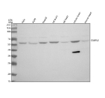 Western blot analysis of OSBPL2 using anti-OSBPL2 antibody. Lane 1: human Hela whole cell lysates, Lane 2: human whole cell lysates, Lane 3: human HepG2 whole cell lysates, Lane 4: rat brain tissue lysates, Lane 5: rat heart tissue lysates, Lane 6: mouse brain tissue lysates, Lane 7: mouse heart tissue lysates. After electrophoresis, proteins were transferred to a nitrocellulose membrane at 150 mA for 50-90 minutes. Blocked the membrane with 5% non-fat milk/TBS for 1.5 hour at RT. The membrane was incubated with rabbit anti-OSBPL2 antibody at 0.5 ug/ml overnight at 4oC, then washed with TBS-0.1%Tween 3 times with 5 minutes each and probed with a goat anti-rabbit IgG-HRP secondary antibody at a dilution of 1:5000 for 1.5 hour at RT. The signal was developed using enhanced chemiluminescent. A specific band was detected for OSBPL2 at approximately 55 kDa. The expected molecular weight of OSBPL2 is ~55 kDa.