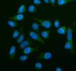 Immunofluorescent staining of OSBPL2 using anti-OSBPL2 antibody (green). OSBPL2 was detected in an immunocytochemical section of HELA cells. Enzyme antigen retrieval was performed using IHC enzyme antigen retrieval reagent for 15 mins. The cells were blocked with 10% goat serum. And then incubated with 5 ug/ml rabbit anti-OSBPL2 antibody overnight at 4oC. DyLight 488 Conjugated Goat Anti-Rabbit IgG was used as secondary antibody at 1:500 dilution and incubated for 30 minutes at 37oC. The section was counterstained with DAPI nuclear stain (blue). Visualize using a fluorescence microscope and filter sets appropriate for the label used.