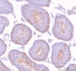Immunohistochemical staining of STK31 using anti-STK31 antibody. STK31 was detected in a paraffin-embedded section of mouse testis tissue. Heat mediated antigen retrieval was performed in EDTA buffer (pH 8.0, epitope retrieval solution). The tissue section was blocked with 10% goat serum. The tissue section was then incubated with 2 ug/ml rabbit anti-STK31 antibody overnight at 4oC. Peroxidase Conjugated Goat Anti-rabbit IgG was used as secondary antibody and incubated for 30 minutes at 37oC. The tissue section was developed using an HRP secondary and DAB substrate.