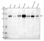 Western blot analysis of STK31 using anti-STK31 antibody. Lane 1: human Caco-2 whole cell lysates, Lane 2: human whole cell lysates, Lane 3: human MCF-7 whole cell lysates, Lane 4: rat testis tissue lysates, Lane 5: rat C6 whole cell lysates, Lane 6: mouse testis tissue lysates, Lane 7: mouse NIH/3T3 whole cell lysates. After electrophoresis, proteins were transferred to a nitrocellulose membrane at 150 mA for 50-90 minutes. Blocked the membrane with 5% non-fat milk/TBS for 1.5 hour at RT. The membrane was incubated with rabbit anti-STK31 antibody at 0.5 ug/ml overnight at 4oC, then washed with TBS-0.1%Tween 3 times with 5 minutes each and probed with a goat anti-rabbit IgG-HRP secondary antibody at a dilution of 1:5000 for 1.5 hour at RT. The signal was developed using enhanced chemiluminescent. Although the theoretical mass is ~116 kDa, endogenous STK31 typically migrates at ~120-130 kDa on SDSâPAGE, likely due to phosphorylation and sequence-dependent anomalous mobility.
