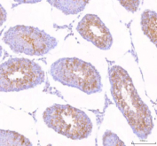 Immunohistochemical staining of STK31 using anti-STK31 antibody. STK31 was detected in a paraffin-embedded section of rat testis tissue. Heat mediated antigen retrieval was performed in EDTA buffer (pH 8.0, epitope retrieval solution). The tissue section was blocked with 10% goat serum. The tissue section was then incubated with 2 ug/ml rabbit anti-STK31 antibody overnight at 4oC. Peroxidase Conjugated Goat Anti-rabbit IgG was used as secondary antibody and incubated for 30 minutes at 37oC. The tissue section was developed using an HRP secondary and DAB substrate.