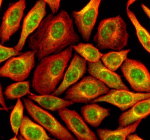 Immunofluorescent staining of MTMR3 using anti-MTMR3 antibody (green) and anti-Beta Tubulin antibody (red). MTMR3 was detected in an immunocytochemical section of SIHA cells. Enzyme antigen retrieval was performed using IHC enzyme antigen retrieval reagent for 15 mins. The cells were blocked with 10% goat serum. And then incubated with 5 ug/ml rabbit anti-MTMR3 antibody and mouse anti-Beta Tubulin antibody overnight at 4oC. DyLight 488 Conjugated Goat Anti-Rabbit IgG and Cy3 Conjugated Goat Anti-Mouse IgG were used as secondary antibody at 1:500 dilution and incubated for 30 minutes at 37oC. Visualize using a fluorescence microscope and filter sets appropriate for the label used.