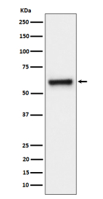 Western blot analysis of FPGS expression in human HeLa cell lysate using FPGS antibody. Predicted molecular weight ~65 kDa.