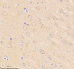 Immunohistochemical staining of SIK2 using anti-SIK2 antibody. SIK2 was detected in a paraffin-embedded section of rat brain tissue. Heat mediated antigen retrieval was performed in EDTA buffer (pH 8.0, epitope retrieval solution). The tissue section was blocked with 10% goat serum. The tissue section was then incubated with 2 ug/ml rabbit anti-SIK2 antibody overnight at 4oC. Peroxidase Conjugated Goat Anti-rabbit IgG was used as secondary antibody and incubated for 30 minutes at 37oC. The tissue section was developed using an HRP secondary and DAB substrate.