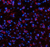 Immunofluorescent staining of SIK2 using anti-SIK2 antibody (red). SIK2 was detected in a paraffin-embedded section of rat brain tissue. Heat mediated antigen retrieval was performed in EDTA buffer (pH 8.0, epitope retrieval solution). The tissue section was blocked with 10% goat serum. The tissue section was then incubated with 5 ug/ml rabbit anti-SIK2 antibody overnight at 4oC. Cy3 Conjugated Goat Anti-Rabbit IgG was used as secondary antibody at 1:500 dilution and incubated for 30 minutes at 37oC. The section was counterstained with DAPI nuclear stain (blue). Visualize using a fluorescence microscope and filter sets appropriate for the label used.