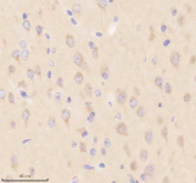 Immunohistochemical staining of SIK2 using anti-SIK2 antibody. SIK2 was detected in a paraffin-embedded section of mouse brain tissue. Heat mediated antigen retrieval was performed in EDTA buffer (pH 8.0, epitope retrieval solution). The tissue section was blocked with 10% goat serum. The tissue section was then incubated with 2 ug/ml rabbit anti-SIK2 antibody overnight at 4oC. Peroxidase Conjugated Goat Anti-rabbit IgG was used as secondary antibody and incubated for 30 minutes at 37oC. The tissue section was developed using an HRP secondary and DAB substrate.