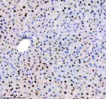 Immunohistochemical staining of TRIM47 using anti-TRIM47 antibody. TRIM47 was detected in a paraffin-embedded section of mouse liver tissue. Heat mediated antigen retrieval was performed in EDTA buffer (pH 8.0, epitope retrieval solution). The tissue section was blocked with 10% goat serum. The tissue section was then incubated with 2 ug/ml rabbit anti-TRIM47 antibody overnight at 4oC. Peroxidase Conjugated Goat Anti-rabbit IgG was used as secondary antibody and incubated for 30 minutes at 37oC. The tissue section was developed using an HRP secondary and DAB substrate.