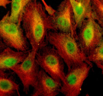 Immunofluorescent staining of TRIM47 using anti-TRIM47 antibody (green) and anti-Alpha Tubulin antibody (red). TRIM47 was detected in an immunocytochemical section of cells. Enzyme antigen retrieval was performed using IHC enzyme antigen retrieval reagent for 15 mins. The cells were blocked with 10% goat serum. And then incubated with 5 ug/ml rabbit anti-TRIM47 antibody and mouse anti-Beta Tubulin antibody overnight at 4oC. DyLight 488 Conjugated Goat Anti-Rabbit IgG and Cy3 Conjugated Goat Anti-Mouse IgG were used as secondary antibody at 1:500 dilution and incubated for 30 minutes at 37oC. Visualize using a fluorescence microscope and filter sets appropriate for the label used.