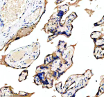 Immunohistochemical staining of ADAM12 using anti-ADAM12 antibody. ADAM12 was detected in a paraffin-embedded section of human placenta tissue. Heat mediated antigen retrieval was performed in EDTA buffer (pH 8.0, epitope retrieval solution). The tissue section was blocked with 10% goat serum. The tissue section was then incubated with 2 ug/ml rabbit anti-ADAM12 antibody overnight at 4oC. Peroxidase Conjugated Goat Anti-rabbit IgG was used as secondary antibody and incubated for 30 minutes at 37oC. The tissue section was developed using an HRP secondary and DAB substrate.