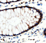 Immunohistochemical staining of REST using anti-REST antibody. REST was detected in a paraffin-embedded section of human colon tissue. Heat mediated antigen retrieval was performed in EDTA buffer (pH 8.0, epitope retrieval solution). The tissue section was blocked with 10% goat serum. The tissue section was then incubated with 2 ug/ml rabbit anti-REST antibody overnight at 4oC. Peroxidase Conjugated Goat Anti-rabbit IgG was used as secondary antibody and incubated for 30 minutes at 37oC. The tissue section was developed using an HRP secondary and DAB substrate.