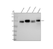 Western blot analysis of ICAM1 using anti-ICAM1 antibody. Electrophoresis was performed on a 8% SDS-PAGE gel at 80V (Stacking gel) / 120V (Resolving gel) for 2 hours. Lane 1: mouse liver tissue lysates, Lane 2: mouse spleen tissue lysates, Lane 3: mouse kidney tissue lysates, Lane 4: mouse RAW264.7 whole cell lysates. After electrophoresis, proteins were transferred to a nitrocellulose membrane at 150 mA for 50-90 minutes. Blocked the membrane with 5% non-fat milk/TBS for 1.5 hour at RT. The membrane was incubated with rabbit anti-ICAM1 antibody at 1:500 overnight at 4oC, then washed with TBS-0.1%Tween 3 times with 5 minutes each and probed with a goat anti-rabbit IgG-HRP secondary antibody at a dilution of 1:5000 for 1.5 hour at RT. The signal was developed using an ECL Plus Western Blotting Substrate. Predicted molecular weight: ~58 kDa (unmodified), 75-115 kDa (glycosylated).