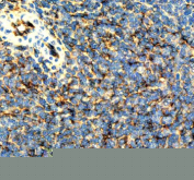 Immunohistochemical staining of ICAM1 using anti-ICAM1 antibody. ICAM1 was detected in a paraffin-embedded section of mouse spleen tissue. Heat mediated antigen retrieval was performed in EDTA buffer (pH 8.0, epitope retrieval solution). The tissue section was blocked with 10% goat serum. The tissue section was then incubated with 1:50 rabbit anti-ICAM1 antibody overnight at 4oC. Peroxidase Conjugated Goat Anti-rabbit IgG was used as secondary antibody and incubated for 30 minutes at 37oC. The tissue section was developed using an HRP secondary and DAB substrate.