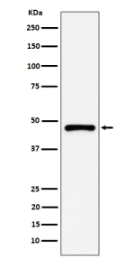 Western blot analysis of PSMC5 expression in human A431 cell lysate. Predicted molecular weight ~46 kDa.