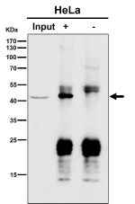 Immunoprecipitation analysis using the antibody at 1:50 dilution. Western blot at 1:1000 dilution. Predicted molecular weight ~46 kDa.