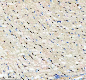 Immunohistochemical staining of PIP5K1A using anti-PIP5K1A antibody. PIP5K1A was detected in a paraffin-embedded section of mouse brain tissue. Heat mediated antigen retrieval was performed in EDTA buffer (pH 8.0, epitope retrieval solution). The tissue section was blocked with 10% goat serum. The tissue section was then incubated with 2 ug/ml rabbit anti-PIP5K1A antibody overnight at 4oC. Peroxidase Conjugated Goat Anti-rabbit IgG was used as secondary antibody and incubated for 30 minutes at 37oC. The tissue section was developed using an HRP secondary and DAB substrate.