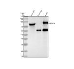Immunoprecipitating PIP5K1A in 293T whole cell lysate. Western blot analysis of PIP5K1A using anti-PIP5K1A antibody. Lane 1: 293T whole cell lysates (30ug), Lane 2: Rabbit control IgG instead of anti-PIP5K1A antibody in 293T whole cell lysate, Lane 3: anti-PIP5K1A antibody (2ug) + 293T whole cell lysate (500ug). After electrophoresis, proteins were transferred to a membrane. Then the membrane was incubated with rabbit anti-PIP5K1A antibody at a dilution of 0.5 ug/ml and probed with a goat anti-rabbit IgG-HRP secondary antibody. The signal is developed using ECL Plus Western Blotting Substrate. ImmunoprecipitationâWestern blot of PIP5K1A. Although PIP5K1A is ~62-63 kDa (apparent ~66-70 kDa on SDS-PAGE), IP-WB reveals a 75-80 kDa doublet. Published work shows that phosphorylation of type I PIP5K1A causes a mobility shift, and SUMOylation (e.g., at Lys-244) produces slower-migrating species, consistent with the doublet observed here.