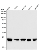 Western blot testing of human samples using the RALA antibody at 1:5000 dilution for 1 hour at room temperature. Predicted molecular weight ~24 kDa.