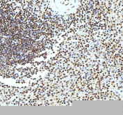 Immunohistochemical staining of Histone H3 using anti-Histone H3 antibody. Histone H3 was detected in a paraffin-embedded section of human spleen tissue. Heat mediated antigen retrieval was performed in EDTA buffer (pH 8.0, epitope retrieval solution). The tissue section was blocked with 10% goat serum. The tissue section was then incubated with 2 ug/ml rabbit anti-Histone H3 antibody overnight at 4oC. Peroxidase Conjugated Goat Anti-rabbit IgG was used as secondary antibody and incubated for 30 minutes at 37oC. The tissue section was developed using an HRP secondary and DAB substrate.