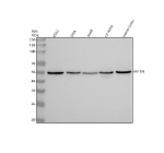 Western blot analysis of MEIOB using anti-MEIOB antibody. Lane 1: human K562 whole cell lysates, Lane 2: human SiHa whole cell lysates, Lane 3: human whole cell lysates, Lane 4: rat testis tissue lysates, Lane 5: mouse testis tissue lysates. After electrophoresis, proteins were transferred to a nitrocellulose membrane at 150 mA for 50-90 minutes. Blocked the membrane with 5% non-fat milk/TBS for 1.5 hour at RT. The membrane was incubated with rabbit anti-MEIOB antibody at 0.5 ug/ml overnight at 4oC, then washed with TBS-0.1%Tween 3 times with 5 minutes each and probed with a goat anti-rabbit IgG-HRP secondary antibody at a dilution of 1:5000 for 1.5 hour at RT. The signal was developed using enhanced chemiluminescent. A specific band was detected for MEIOB at approximately 49 kDa. The expected molecular weight of MEIOB is ~49 kDa.