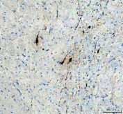 Immunohistochemical staining of TPH2 using anti-TPH2 antibody. TPH2 was detected in a paraffin-embedded section of mouse brain tissue. Heat mediated antigen retrieval was performed in EDTA buffer (pH 8.0, epitope retrieval solution). The tissue section was blocked with 10% goat serum. The tissue section was then incubated with 1:50 rabbit anti-TPH2 antibody overnight at 4oC. Peroxidase Conjugated Goat Anti-rabbit IgG was used as secondary antibody and incubated for 30 minutes at 37oC. The tissue section was developed using an HRP secondary and DAB substrate.