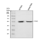 Western blot analysis of TPH2 using anti-TPH2 antibody. Electrophoresis was performed on a 10% SDS-PAGE gel at 80V (Stacking gel) / 120V (Resolving gel) for 2 hours. Lane 1: rat brain tissue lysates, Lane 2: mouse brain tissue lysates. After electrophoresis, proteins were transferred to a nitrocellulose membrane at 150 mA for 50-90 minutes. Blocked the membrane with 5% non-fat milk/TBS for 1.5 hour at RT. The membrane was incubated with rabbit anti-TPH2 antibody at 1:500 overnight at 4oC, then washed with TBS-0.1%Tween 3 times with 5 minutes each and probed with a goat anti-rabbit IgG-HRP secondary antibody at a dilution of 1:5000 for 1.5 hour at RT. The signal was developed using an ECL Plus Western Blotting Substrate. A specific band was detected for TPH2 at approximately 56 kDa. The expected molecular weight of TPH2 is ~56 kDa.