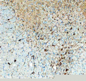 Immunohistochemical staining of TPH2 using anti-TPH2 antibody. TPH2 was detected in a paraffin-embedded section of rat brain tissue. Heat mediated antigen retrieval was performed in EDTA buffer (pH 8.0, epitope retrieval solution). The tissue section was blocked with 10% goat serum. The tissue section was then incubated with 1:50 rabbit anti-TPH2 antibody overnight at 4oC. Peroxidase Conjugated Goat Anti-rabbit IgG was used as secondary antibody and incubated for 30 minutes at 37oC. The tissue section was developed using an HRP secondary and DAB substrate.