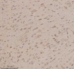 Immunohistochemical staining of OPN3 using anti-OPN3 antibody. OPN3 was detected in a paraffin-embedded section of rat brain tissue. Heat mediated antigen retrieval was performed in EDTA buffer (pH 8.0, epitope retrieval solution). The tissue section was blocked with 10% goat serum. The tissue section was then incubated with 2 ug/ml rabbit anti-OPN3 antibody overnight at 4oC. Peroxidase Conjugated Goat Anti-rabbit IgG was used as secondary antibody and incubated for 30 minutes at 37oC. The tissue section was developed using an HRP secondary and DAB substrate.