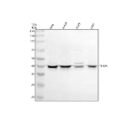 Western blot analysis of TFAP4 using anti-TFAP4 antibody. Electrophoresis was performed on a 10% SDS-PAGE gel at 80V (Stacking gel) / 120V (Resolving gel) for 2 hours. Lane 1: human Hela whole cell lysates, Lane 2: human Jurkat whole cell lysates, Lane 3: human whole cell lysates, Lane 4: human 293T whole cell lysates. After electrophoresis, proteins were transferred to a nitrocellulose membrane at 150 mA for 50-90 minutes. Blocked the membrane with 5% non-fat milk/TBS for 1.5 hour at RT. The membrane was incubated with rabbit anti-TFAP4 antibody at 0.5 ug/ml overnight at 4oC, then washed with TBS-0.1%Tween 3 times with 5 minutes each and probed with a goat anti-rabbit IgG-HRP secondary antibody at a dilution of 1:5000 for 1.5 hour at RT. The signal was developed using an ECL Plus Western Blotting Substrate. The expected molecular weight of TFAP4 is ~39 kDa.