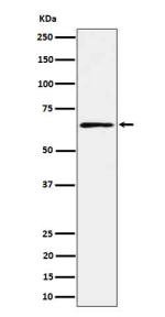 Western blot analysis of RIPK2 in human K562 cell lysate using RIPK2 antibody. Expected molecular weight ~61 kDa.
