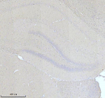 Immunohistochemical staining of NF-M/NEFM using anti-NEFM antibody. NF-M/NEFM was detected in a paraffin-embedded section of rat brain tissue. Heat mediated antigen retrieval was performed in EDTA buffer (pH 8.0, epitope retrieval solution). The tissue section was blocked with 10% goat serum. The tissue section was then incubated with 2 ug/ml rabbit anti-NEFM antibody overnight at 4oC. Peroxidase Conjugated Goat Anti-rabbit IgG was used as secondary antibody and incubated for 30 minutes at 37oC. The tissue section was developed using an HRP secondary and DAB substrate.