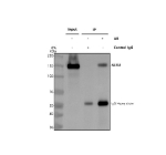 Immunoprecipitating NF-M/NEFM in SH-SY5Y whole cell lysate. Western blot analysis of NF-M/NEFM using anti-NEFM antibody. Lane 1: SH-SY5Y whole cell lysates (30ug), Lane 2: Rabbit control IgG instead of anti-NEFM antibody in SH-SY5Y whole cell lysate, Lane 3: anti-NEFM antibody (2ug) + SH-SY5Y whole cell lysate (500ug). After electrophoresis, proteins were transferred to a membrane. Then the membrane was incubated with rabbit anti-NEFM antibody at a dilution of 0.5 ug/ml and probed with a goat anti-rabbit IgG-HRP secondary antibody. The signal is developed using ECL Plus Western Blotting Substrate. A specific band was detected for NF-M/NEFM at approximately 160 kDa. The expected molecular weight of NF-M/NEFM is at 102 kDa.