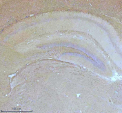 Immunohistochemical staining of NF-M/NEFM using anti-NEFM antibody. NF-M/NEFM was detected in a paraffin-embedded section of mouse brain tissue. Heat mediated antigen retrieval was performed in EDTA buffer (pH 8.0, epitope retrieval solution). The tissue section was blocked with 10% goat serum. The tissue section was then incubated with 2 ug/ml rabbit anti-NEFM antibody overnight at 4oC. Peroxidase Conjugated Goat Anti-rabbit IgG was used as secondary antibody and incubated for 30 minutes at 37oC. The tissue section was developed using an HRP secondary and DAB substrate.
