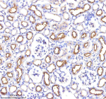 Immunohistochemical staining of ACE using anti-ACE antibody. ACE was detected in a paraffin-embedded section of mouse kidney tissue. Heat mediated antigen retrieval was performed in EDTA buffer (pH 8.0, epitope retrieval solution). The tissue section was blocked with 10% goat serum. The tissue section was then incubated with 2 ug/ml rabbit anti-ACE antibody overnight at 4oC. Peroxidase Conjugated Goat Anti-rabbit IgG was used as secondary antibody and incubated for 30 minutes at 37oC. The tissue section was developed using an HRP secondary and DAB substrate.