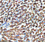 Immunohistochemical staining of MSTO1 using anti-MSTO1 antibody. MSTO1 was detected in a paraffin-embedded section of human liver tissue. Heat mediated antigen retrieval was performed in EDTA buffer (pH 8.0, epitope retrieval solution). The tissue section was blocked with 10% goat serum. The tissue section was then incubated with 2 ug/ml rabbit anti-MSTO1 antibody overnight at 4oC. Peroxidase Conjugated Goat Anti-rabbit IgG was used as secondary antibody and incubated for 30 minutes at 37oC. The tissue section was developed using an HRP secondary and DAB substrate.