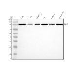 Western blot analysis of GALC using anti-GALC antibody. Electrophoresis was performed on a 10% SDS-PAGE gel at 80V (Stacking gel) / 120V (Resolving gel) for 2 hours. Lane 1: human whole cell lysates, Lane 2: human whole cell lysates, Lane 3: human SH-SY5Y whole cell lysates, Lane 4: human HEL whole cell lysates, Lane 5: rat brain tissue lysates, Lane 6: mouse brain tissue lysates. After electrophoresis, proteins were transferred to a nitrocellulose membrane at 150 mA for 50-90 minutes. Blocked the membrane with 5% non-fat milk/TBS for 1.5 hour at RT. The membrane was incubated with rabbit anti-GALC antibody at 1:1000 overnight at 4oC, then washed with TBS-0.1%Tween 3 times with 5 minutes each and probed with a goat anti-rabbit IgG-HRP secondary antibody at a dilution of 1:5000 for 1.5 hour at RT. The signal was developed using an ECL Plus Western Blotting Substrate. A single major band is detected at approximately 100 kDa, higher than the predicted molecular weight of 77 kDa. This upward shift is well documented for GALC and reflects its heavily N-glycosylated precursor form. The enzyme is synthesized as a ~100 kDa glycoprotein that is subsequently cleaved within lysosomes into smaller subunits, although only the full-length precursor is prominent in whole-cell lysates.