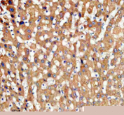 Immunohistochemical staining of TDO2 using anti-TDO2 antibody. TDO2 was detected in a paraffin-embedded section of human liver tissue. Heat mediated antigen retrieval was performed in EDTA buffer (pH 8.0, epitope retrieval solution). The tissue section was blocked with 10% goat serum. The tissue section was then incubated with 2 ug/ml rabbit anti-TDO2 antibody overnight at 4oC. Peroxidase Conjugated Goat Anti-rabbit IgG was used as secondary antibody and incubated for 30 minutes at 37oC. The tissue section was developed using an HRP secondary and DAB substrate.