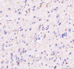 Immunohistochemical staining of GBF1 using anti-GBF1 antibody. GBF1 was detected in a paraffin-embedded section of rat brain tissue. Heat mediated antigen retrieval was performed in EDTA buffer (pH 8.0, epitope retrieval solution). The tissue section was blocked with 10% goat serum. The tissue section was then incubated with 2 ug/ml rabbit anti-GBF1 antibody overnight at 4oC. Peroxidase Conjugated Goat Anti-rabbit IgG was used as secondary antibody and incubated for 30 minutes at 37oC. The tissue section was developed using an HRP secondary and DAB substrate.