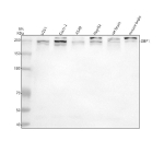 Western blot analysis of GBF1 using anti-GBF1 antibody. Electrophoresis was performed on a 8% SDS-PAGE gel at 80V (Stacking gel) / 120V (Resolving gel) for 2 hours. Lane 1: human U251 whole cell lysates, Lane 2: human Caco-2 whole cell lysates, Lane 3: human whole cell lysates, Lane 4: human HepG2 whole cell lysates, Lane 5: rat brain tissue lysates, Lane 6: mouse brain tissue lysates. After electrophoresis, proteins were transferred to a nitrocellulose membrane at 150 mA for 50-90 minutes. Blocked the membrane with 5% non-fat milk/TBS for 1.5 hour at RT. The membrane was incubated with rabbit anti-GBF1 antibody at 0.5 ug/ml overnight at 4oC, then washed with TBS-0.1%Tween 3 times with 5 minutes each and probed with a goat anti-rabbit IgG-HRP secondary antibody at a dilution of 1:5000 for 1.5 hour at RT. The signal was developed using an ECL Plus Western Blotting Substrate. Although GBF1 has a predicted molecular weight of ~207 kDa, it consistently migrates at ~240-260 kDa on SDSâPAGE, as reported in previous biochemical studies. The slower migration is due to GBF1âs extended coiled-coil structure and multiple phosphorylation sites, which affect SDS binding. Additional faint bands above or below this region likely represent differentially modified or partially processed forms of GBF1 present in distinct cell and tissue types.