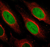 Immunofluorescent staining of NUSAP1 using anti-NUSAP1 antibody (green) and anti-Beta Tubulin antibody (red). NUSAP1 was detected in an immunocytochemical section of U2OS cells. Enzyme antigen retrieval was performed using IHC enzyme antigen retrieval reagent for 15 mins. The cells were blocked with 10% goat serum. And then incubated with 5 ug/ml rabbit anti-NUSAP1 antibody and mouse anti-Beta Tubulin antibody overnight at 4oC. DyLight 488 Conjugated Goat Anti-Rabbit IgG and Cy3 Conjugated Goat Anti-Mouse IgG were used as secondary antibody at 1:500 dilution and incubated for 30 minutes at 37oC. Visualize using a fluorescence microscope and filter sets appropriate for the label used.