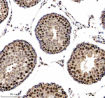 Immunohistochemical staining of NUSAP1 using anti-NUSAP1 antibody. NUSAP1 was detected in a paraffin-embedded section of rat testis tissue. Heat mediated antigen retrieval was performed in EDTA buffer (pH 8.0, epitope retrieval solution). The tissue section was blocked with 10% goat serum. The tissue section was then incubated with 1:100 rabbit anti-NUSAP1 antibody overnight at 4oC. Peroxidase Conjugated Goat Anti-rabbit IgG was used as secondary antibody and incubated for 30 minutes at 37oC. The tissue section was developed using an HRP secondary and DAB substrate.