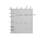 Western blot analysis of VPS34/PIK3C3 using anti-PIK3C3 antibody. Electrophoresis was performed on a 8% SDS-PAGE gel at 80V (Stacking gel) / 120V (Resolving gel) for 2 hours. Lane 1: human Hela whole cell lysates, Lane 2: human 293T whole cell lysates, Lane 3: human SH-SY5Y whole cell lysates, Lane 4: human Jurkat whole cell lysates. After electrophoresis, proteins were transferred to a nitrocellulose membrane at 150 mA for 50-90 minutes. Blocked the membrane with 5% non-fat milk/TBS for 1.5 hour at RT. The membrane was incubated with rabbit anti-PIK3C3 antibody at 0.5 ug/ml overnight at 4oC, then washed with TBS-0.1%Tween 3 times with 5 minutes each and probed with a goat anti-rabbit IgG-HRP secondary antibody at a dilution of 1:5000 for 1.5 hour at RT. The signal was developed using an ECL Plus Western Blotting Substrate. A predominant band is detected at ~110-120 kDa, running above the calculated ~102 kDa, consistent with the known migration of Vps34 within class III PI3K complexes and possible phosphorylation-dependent mobility. A lighter band at ~65 kDa is also observed and likely represents a proteolytic fragment of Vps34 that can appear in stressed samples or with incomplete protease inhibition.