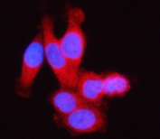Immunofluorescent staining of SSSCA1/ZNRD2 using anti-ZNRD2 antibody (red). ZNRD2 was detected in an immunocytochemical section of PC-3 cells. Enzyme antigen retrieval was performed using IHC enzyme antigen retrieval reagent for 15 mins. The cells were blocked with 10% goat serum. And then incubated with 5 ug/ml rabbit anti-ZNRD2 antibody overnight at 4oC. Cy3 Conjugated Goat Anti-Rabbit IgG was used as secondary antibody at 1:500 dilution and incubated for 30 minutes at 37oC. The section was counterstained with DAPI nuclear stain (blue). Visualize using a fluorescence microscope and filter sets appropriate for the label used.