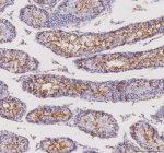 Immunohistochemical staining of STK16 using anti-STK16 antibody. STK16 was detected in a paraffin-embedded section of mouse testis tissue. Heat mediated antigen retrieval was performed in EDTA buffer (pH 8.0, epitope retrieval solution). The tissue section was blocked with 10% goat serum. The tissue section was then incubated with 2 ug/ml rabbit anti-STK16 antibody overnight at 4oC. Peroxidase Conjugated Goat Anti-rabbit IgG was used as secondary antibody and incubated for 30 minutes at 37oC. The tissue section was developed using an HRP secondary and DAB substrate.