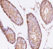 Immunohistochemical staining of STK16 using anti-STK16 antibody. STK16 was detected in a paraffin-embedded section of rat testis tissue. Heat mediated antigen retrieval was performed in EDTA buffer (pH 8.0, epitope retrieval solution). The tissue section was blocked with 10% goat serum. The tissue section was then incubated with 2 ug/ml rabbit anti-STK16 antibody overnight at 4oC. Peroxidase Conjugated Goat Anti-rabbit IgG was used as secondary antibody and incubated for 30 minutes at 37oC. The tissue section was developed using an HRP secondary and DAB substrate.