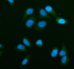 Immunofluorescent staining of STRN3 using anti-STRN3 antibody (green). STRN3 was detected in an immunocytochemical section of human HELA cells. Enzyme antigen retrieval was performed using IHC enzyme antigen retrieval reagent for 15 mins. The cells were blocked with 10% goat serum. And then incubated with 5 ug/ml rabbit anti-STRN3 antibody overnight at 4oC. DyLight 488 Conjugated Goat Anti-Rabbit IgG was used as secondary antibody at 1:500 dilution and incubated for 30 minutes at 37oC. The section was counterstained with DAPI nuclear stain (blue). Visualize using a fluorescence microscope and filter sets appropriate for the label used.
