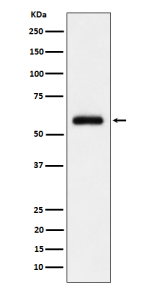 Western blot analysis of TFIIE alpha/GTF2E1 expression in HeLa cell lysate using GTF2E1 antibody. Commonly observed at 60-65 kDa.