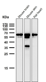 Western blot testing of mouse and rat samples using the GTF2E1 antibody at 1:1000 dilution for 1 hour at room temperature. A dominant band is detected at ~60-65 kDa with a second band at ~50-55 kDa, although the calculated molecular weight is ~49 kDa. The higher-migrating species is consistent with hyper-phosphorylated TFIIE alpha during transcription initiation, while the lower band represents a less-phosphorylated form.