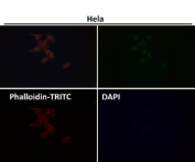 Immunofluorescent analysis using the GTF2E1 antibody at 1:150 dilution.
